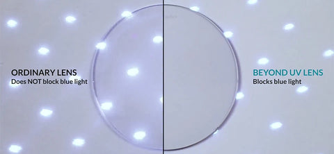 ZENOTTIC Cat Eye Acetate Prescription Eyeglasses Women Anti-Blue-Ray Photochromic Optical Spectacles Myopia Hyperopia Glasses